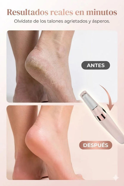 REMOVEDOR ELECTRICO DE CALLOS PARA PIES RECARGABLE